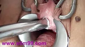 Bagaimana kisah luca ...